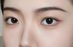 焕亮双眸，遇见“睛”彩！广东郑明明呵护年轻眼周